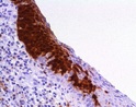 p16 INK4a Antikörper jetzt als  CE-IVD