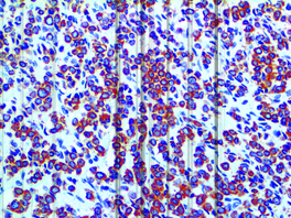 Tinto Cytokeratin LMW CAM5.2, CAM5.2, 3,0 ml, Reference: BSB 2056