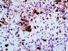 Tinto Herpes Simplex Virus II, polyclonal, 3,0 ml, Artikel-Nr.: BSB 2335