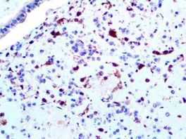 Tinto Herpes Simplex Virus I, polyclonal, 3,0 ml, Artikel-Nr.: BSB 2426