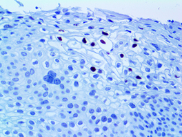 Tinto HPV16, CAMVIR-1, 3,0 ml, Artikel-Nr.: BSB 2943