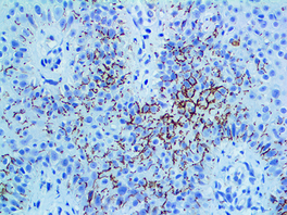 Tinto Treponema pallidum, polyclonal, 3,0 ml, Reference: BSB 3232