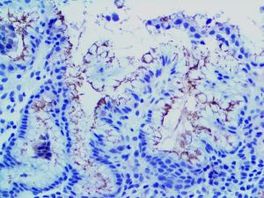Tinto Helicobacter Pylori, EP279, 3,0 ml, Artikel-Nr.: BSB 3279