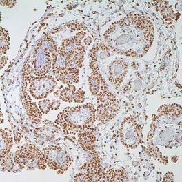 WT1 (Wilms Tumor 1 Protein), 6F-H2, 0,1 ml, Reference: 348M-94