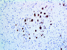Tinto Myoglobin, BSB-104, 7,0 ml, Artikel-Nr.: BSB 3385