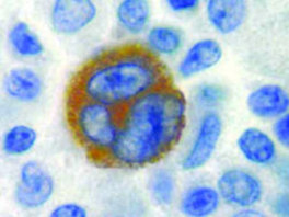 Tinto Epstein Barr Virus, LMP1, CS1-4, 3,0 ml, Reference: BSB 5484