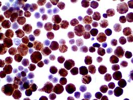 Tinto Herpes Simplex Virus I & II, polyclonal, 15 ml, Artikel-Nr.: BSB 5640