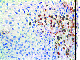 Tinto HPV, BSB-66, 3,0 ml, Artikel-Nr.: BSB 5652
