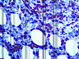 Tinto Myeloperoxidase, polyclonal, 3,0 ml, Artikel-Nr.: BSB 5785