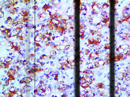 Renal Cell Carcinoma, PN-15, 0,5 ml, Artikel-Nr.: BSB 5914
