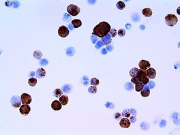 Tinto Herpes Simplex Virus II, BSB-116, 3,0 ml, Artikel-Nr.: BSB 3462