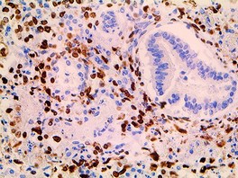 Tinto Herpes Simplex Virus I & II, 10A3 + BSB-116, 3,0 ml, Artikel-Nr.: BSB 3469