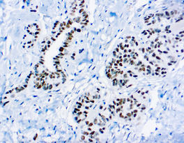 Wilms Tumor 1 Protein (WT1), 6F-H2, 0,1 ml, Artikel-Nr.: MOB437-01