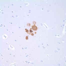 Toxoplasma gondii, polyclonal, 0,1 ml, Artikel-Nr.: 220A-14-RUO