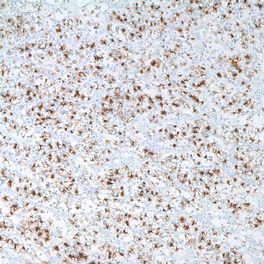 Renal Cell Carcinoma (RCC), PN-15, 0,1 ml, Artikel-Nr.: 329M-94