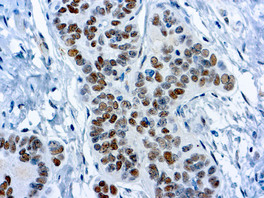 Wilms Tumor 1 Protein (WT1), 6F-H2, 1,0 ml, Reference: MOB437