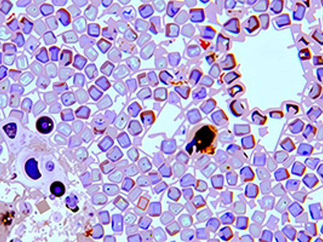 Immunhistochemie