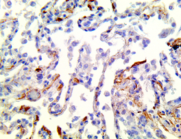 Available now: SARS-CoV-2 antibodies for IHC
