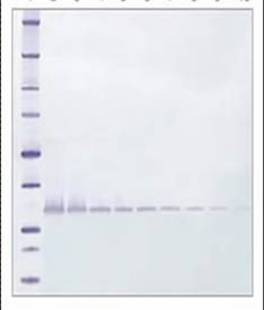 TMB Membrane Peroxidase Substrate System, 440 ml, Reference: 5420-0025